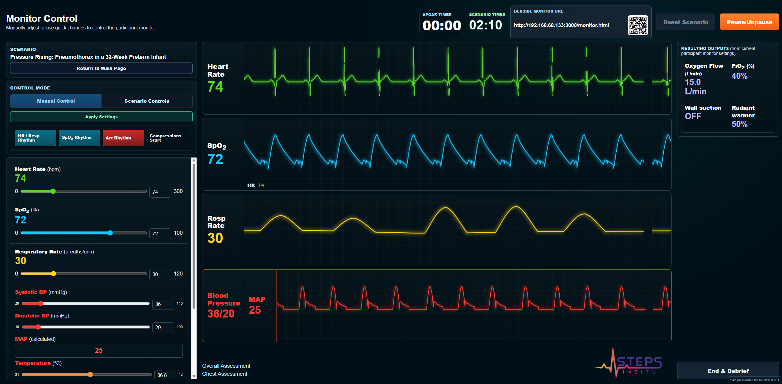 Steps InSitu host controller displaying the pneumothorax scenario